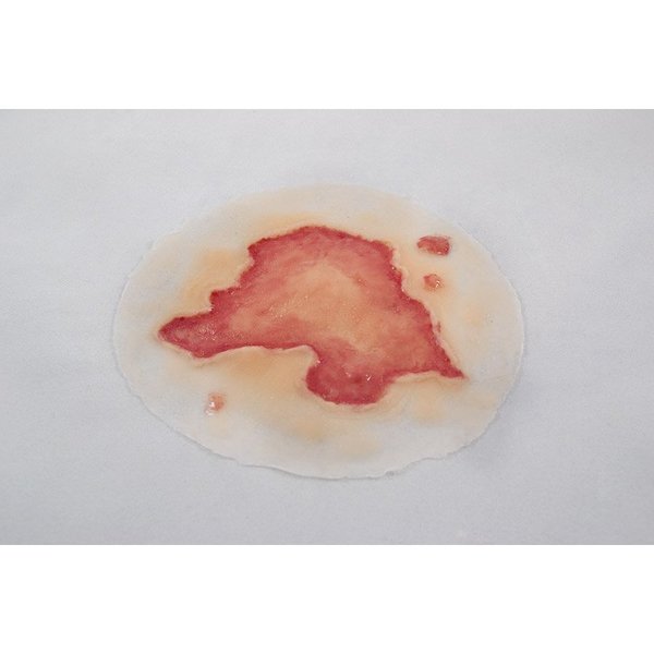 Moulage Science & Training Chemical Burn, Mannequin, PK 4 MST-27-01-04